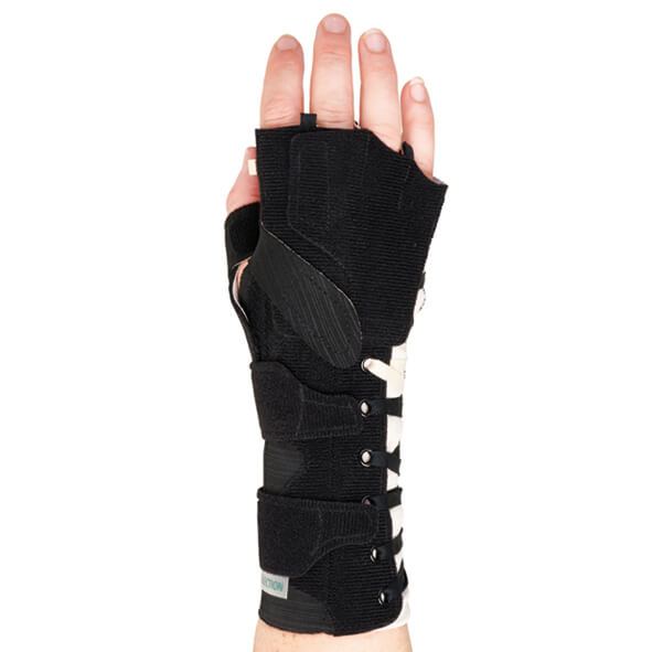 SELECTION® Radialis Fingerdel  